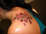 Laser Tattoo Removal - Unwanted Tattoos